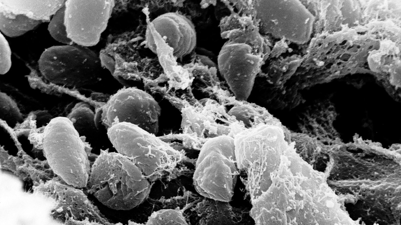 Yersinia pestis, the bacterium responsible for the plague.